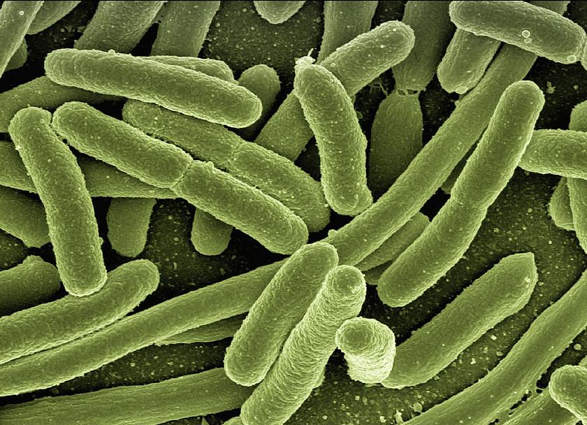 E.-coli-Bakterien stark vergrößert durch ein Elektronenmikroskop. Die kleinen Helfer sollen biogene Solarzellen antreiben.