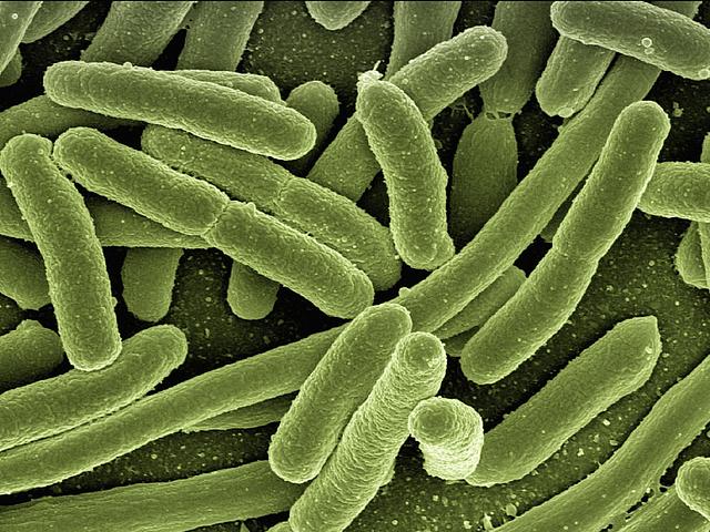 E.-coli-Bakterien stark vergrößert durch ein Elektronenmikroskop. Die kleinen Helfer sollen biogene Solarzellen antreiben.