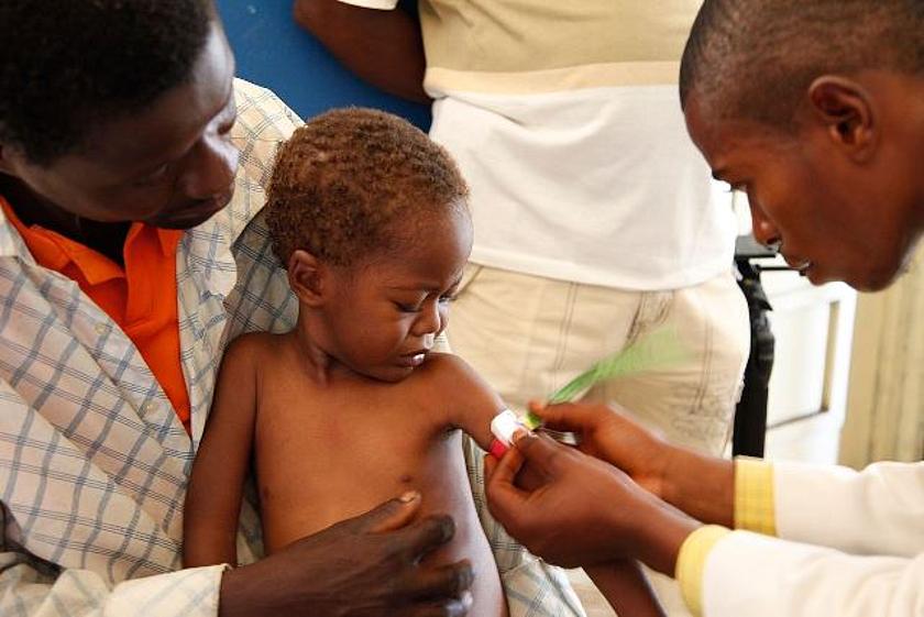 Ein Arzt misst den Armumfang eines unterernährten Kindes in der Demokratischen Republik Kongo (Uploaded by russavia / CC BY-SA 2.0 Wikimedia Commons -https://commons.wikimedia.org/wiki/File:Medical_staff_examine_a_child_for_signs_of_malnourishment_in_DRC
